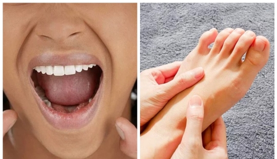 We reduce stress on our own: in which parts of the body stress accumulates We reduce stress on our own: in which parts of the body stress accumulates