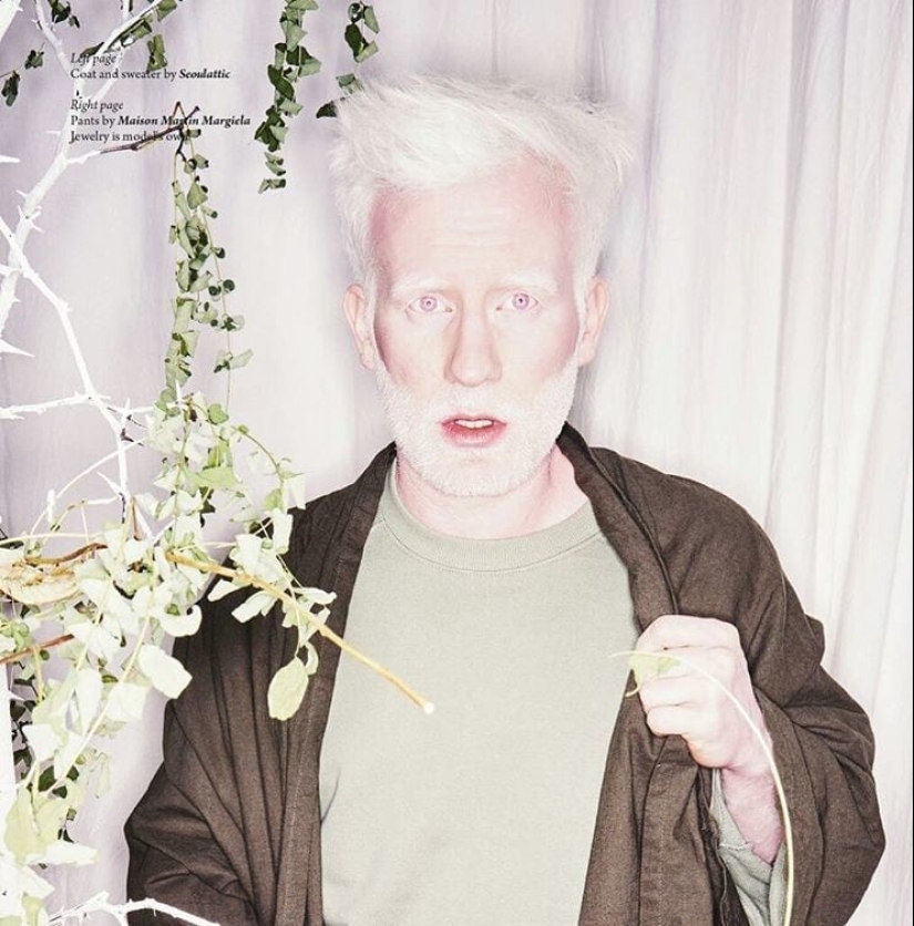 What do albinos of different nationalities and races look like What do albinos of different nationalities and races look like