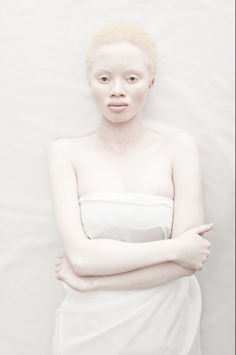 What do albinos of different nationalities and races look like What do albinos of different nationalities and races look like
