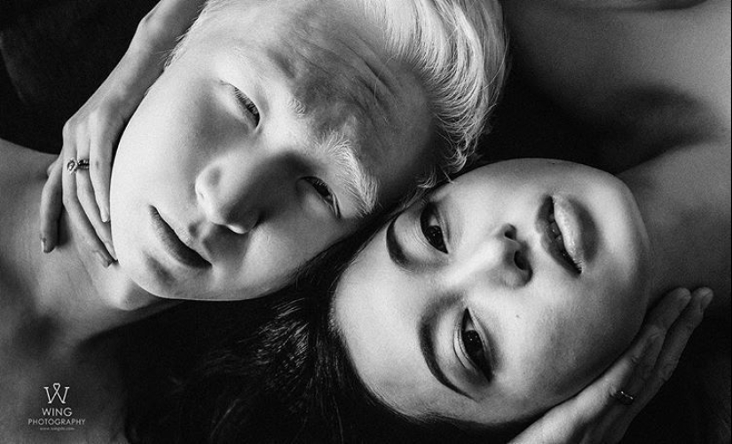 What do albinos of different nationalities and races look like What do albinos of different nationalities and races look like