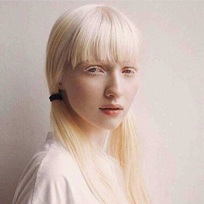 What do albinos of different nationalities and races look like What do albinos of different nationalities and races look like