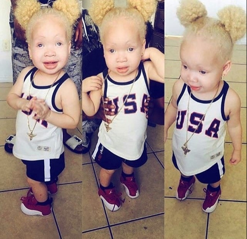 What do albinos of different nationalities and races look like What do albinos of different nationalities and races look like