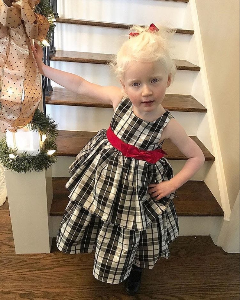 What do albinos of different nationalities and races look like What do albinos of different nationalities and races look like