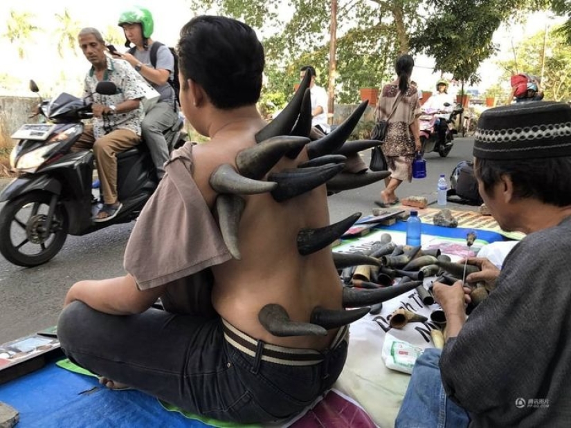Why do street healers put horns on patients' backs in Indonesia Why do street healers put horns on patients' backs in Indonesia