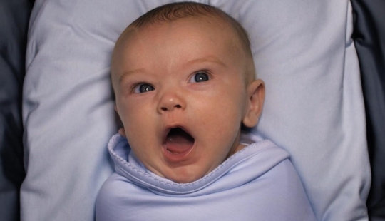 Why is circumcision so popular in the United States? And it's not about hygiene or religion at all