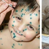 Zelenka and plantain all diseases: all about home medicine in the USSR