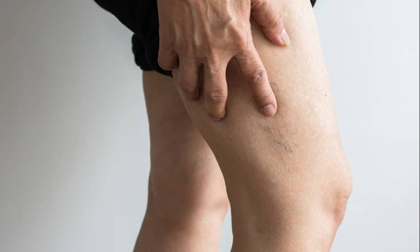 Silent Killer: a deadly condition that occurs after sitting in the office for a long time